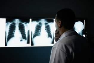 Imagem ilustrativa do artigo Dor no pulmão: 10 principais causas (e o que fazer)