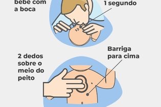 Imagem ilustrativa do artigo Como fazer a massagem cardíaca corretamente