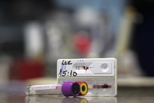 Imagem ilustrativa do artigo Como saber se é dengue: testes e exames de diagnóstico