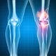 Dolor de rodilla: 11 causas y cómo quitar