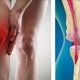 Artrosis de rodilla: síntomas, causas y tratamiento