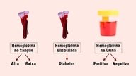 Hemoglobina: qué es, por qué está alta o baja y valores normales