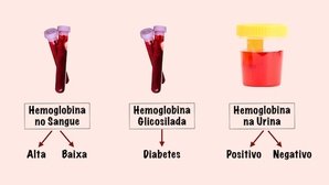 Hemoglobina alta ou baixa: o que significa e valores de referência
