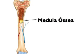 Para que serve e como é feita a biópsia da medula