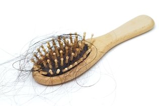Imagem ilustrativa do artigo 5 dicas para evitar a queda de cabelo