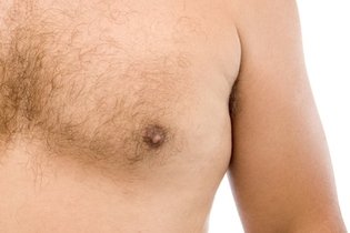Cáncer de mama en hombres: síntomas, tipos y tratamiento