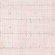 Electrocardiograma: qué es, cómo leer, para qué sirve