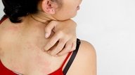 Alergia na pele: sintomas, causas, tipos e tratamento