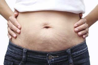 6 Formas de eliminar la flacidez abdominal 