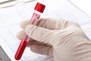 Illustrative image of the article ALT Blood Test: Normal Range & What High Levels Mean