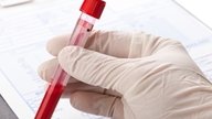ALT Blood Test: What Is It & Normal Range