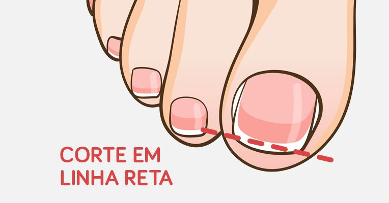 Imagem ilustrativa número 1