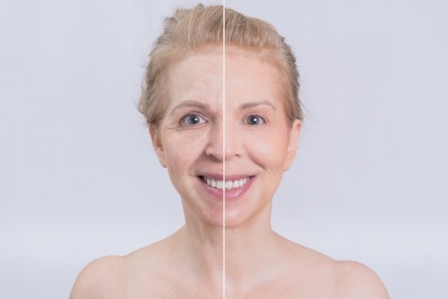 5 طرق للتخلص من ترهلات الوجه