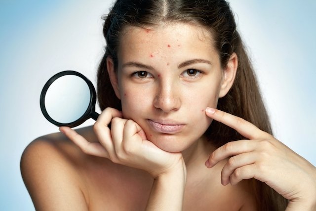 Como identificar e tratar as 6 Doenças de pele mais comuns no Verão