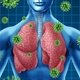 Pneumonia viral: o que é, sintomas, tratamento e prevenção