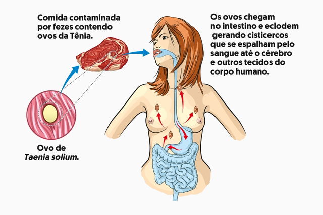 Verme dançante é encontrado em testículo de paciente; entenda o