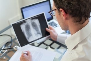 Imagen ilustrativa del artículo Tuberculosis: qué es, síntomas, tipos y tratamiento