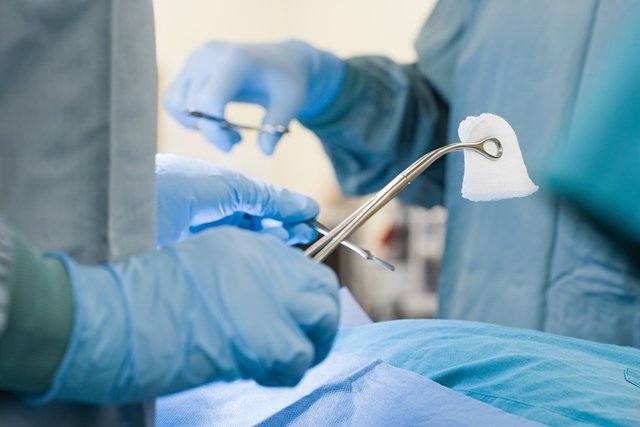 عملية تجميل المؤخرة: ما هي الجراحة وكيف يتم إجراؤها