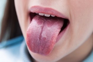 Illustrative image of the article Spots on Tongue: Top 6 Causes & What to Do
