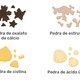4 tipos de pedra nos rins (alimentação e como eliminar)