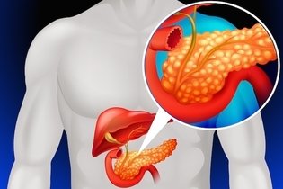 Imagem ilustrativa do artigo Dor no pâncreas: o que pode ser (e o que fazer)