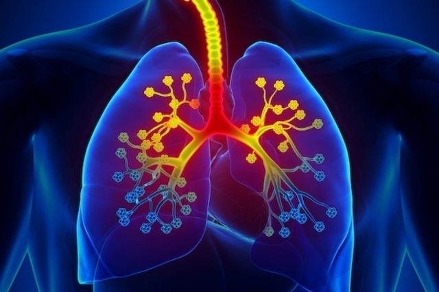 Enfisema Pulmonar Qu Es Principales S Ntomas Y Tratamiento Tua Sa De