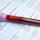 GGT Blood Test: What a High or Low Result Means