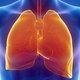 O que é enfisema pulmonar, sintomas e diagnóstico