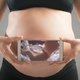 Desprendimiento de placenta: qué es, causas y tratamiento