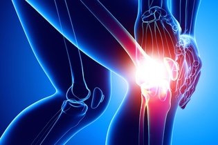 Imagen ilustrativa del artículo 6 remedios caseros para la lesión o golpe en la rodilla