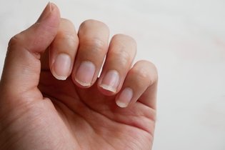 Imagem ilustrativa do artigo 8 dicas simples para fortalecer as unhas