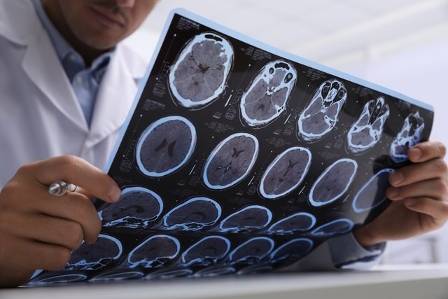 Médico evalúa imágenes cerebrales