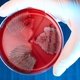 Streptococcus pyogenes: o que é, sintomas e tratamento