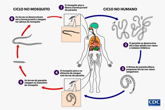 paraziták elephantiasis Giardia paraziták emberek tünetei