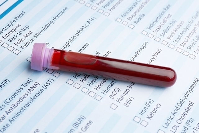 segmented-neutrophils-what-high-low-levels-mean-tua-sa-de