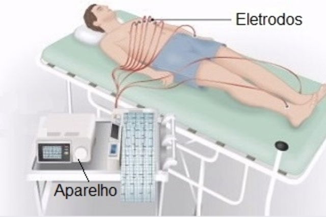 O que é e como é feito o eletrocardiograma - Tua Saúde