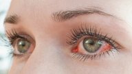Ojos rojos: 13 causas y qué hacer