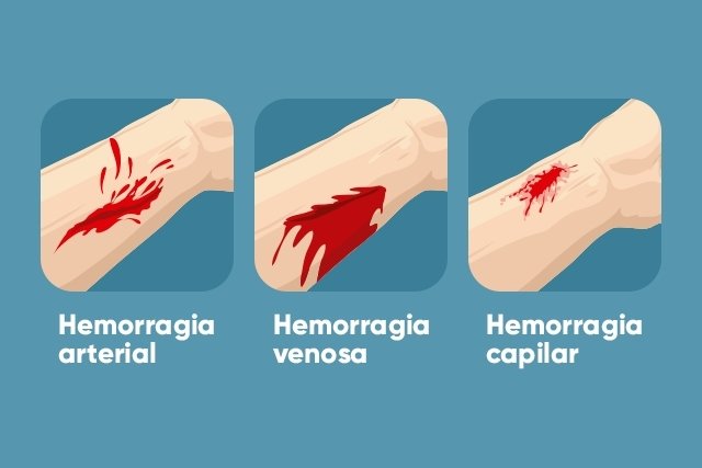 Blog Hemorragias Y Heridas Hemorragias