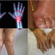 Arthritis Diet : What to Eat & Avoid (with 3-Day Meal Plan)