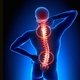 Artrosis de columna: qué es, síntomas y tratamiento