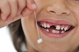 Imagem ilustrativa do artigo Quanto tempo demora para nascer um dente?
