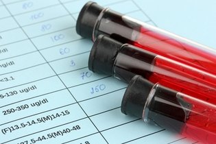Illustrative image of the article BUN Blood Test: What Is It, Uses & What Results Mean