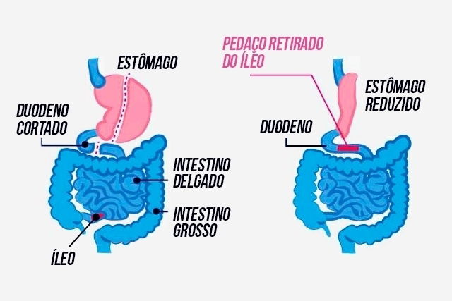 como emagrecer rápido