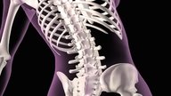 Tratamiento de osteoporosis: medicamentos, alimentos y ejercicios