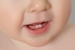 Imagem ilustrativa do artigo Quando levar o bebê ao dentista pela 1ª vez