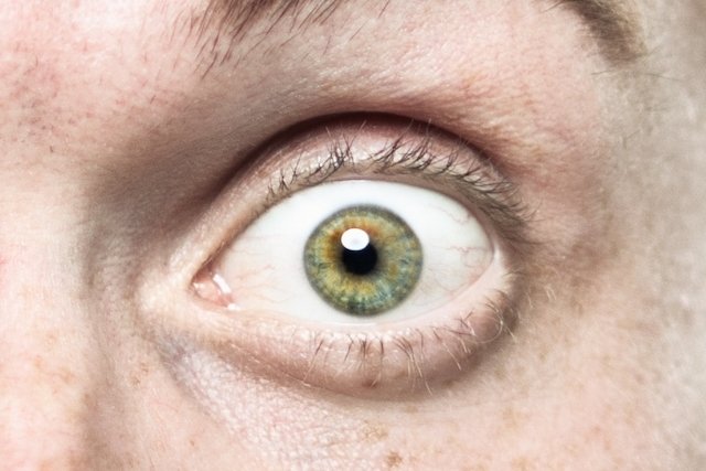 O que os olhos podem dizer sobre sua saúde