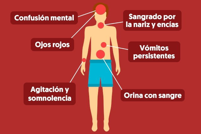 síntomas del dengue