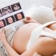 Embarazo semana a semana: cómo se desarrolla el bebé