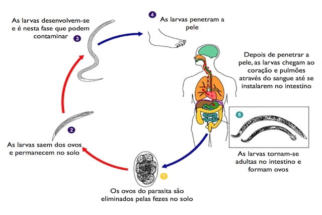 Ancilostom Ase O Que Sintomas Transmiss O E Tratamento Tua Sa De