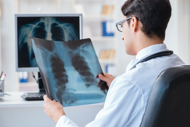Embolia pulmonar: o que é, principais sintomas e causas